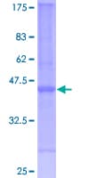 Human CYSTM1 / C5orf32 Protein (Recombinant GST)