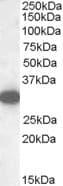 IHC-plus™ Polyclonal Goat anti-Human MGLL / Monoacylglycerol Lipase Antibody (aa17-29, IHC, WB)