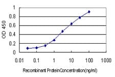 FOXR2 Antibody (clone 2C1)