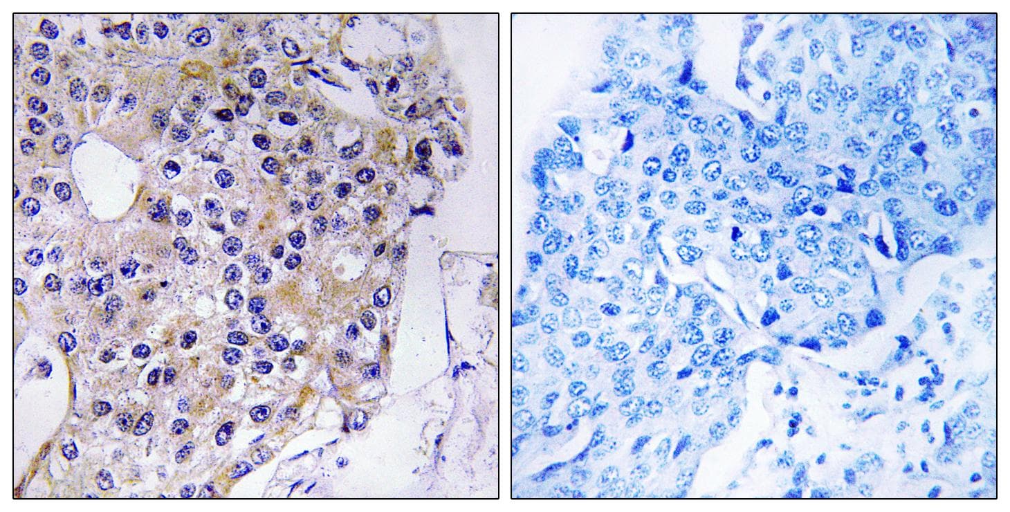 CCP110 Antibody
