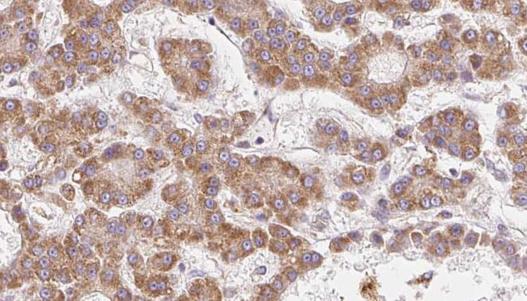 OR2V2 Antibody