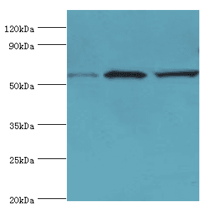 IHC-plus™ ALDH1B1 Antibody (aa278-517)