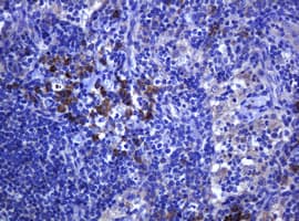 TCL / RHOJ Antibody (clone OTI1A9, Carrier-free)