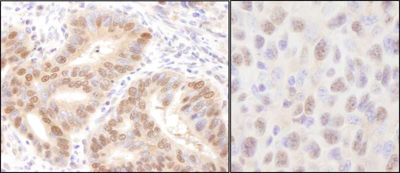 Polyclonal Rabbit anti-Human UBE2A Antibody (N-Terminus, IHC, WB)