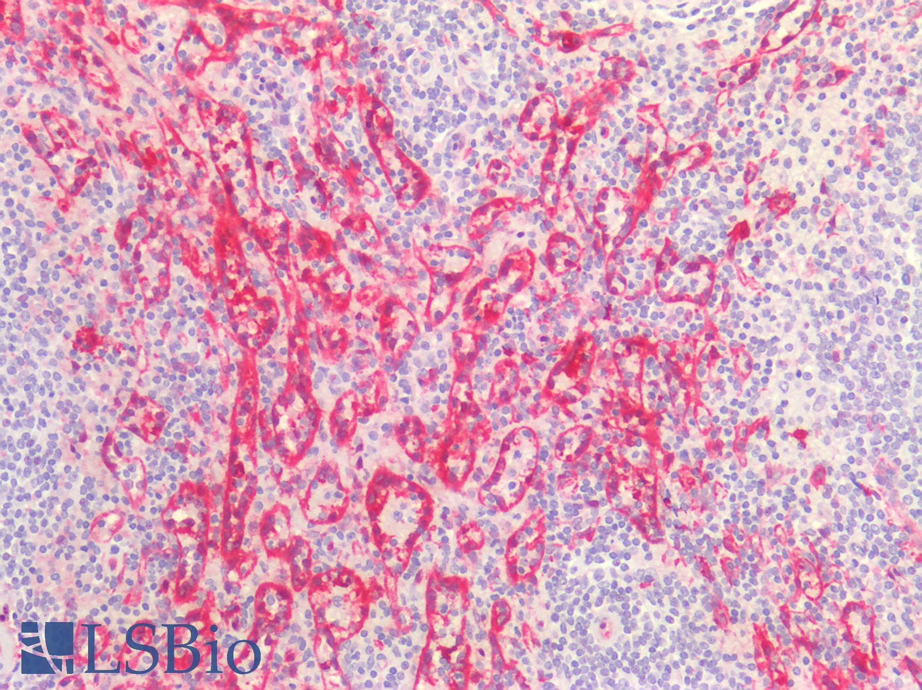 PathPlus™ ALDH1A1 / ALDH1 Antibody (clone 1G6)