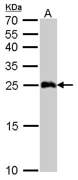 IHC-plus™ Polyclonal Rabbit anti-Human GSTA1 Antibody (IHC, WB)