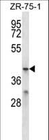 MFSD2B Antibody (aa383-411)