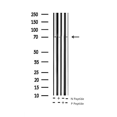 PTPN11 / SHP-2 / NS1 Antibody (phospho-Tyr580)