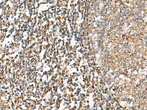 Polyclonal Rabbit anti-Human CHKA / CK / Choline Kinase Antibody (IHC)