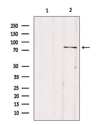 Polyclonal Rabbit anti-Human FACL2 / ACSL1 Antibody (WB)