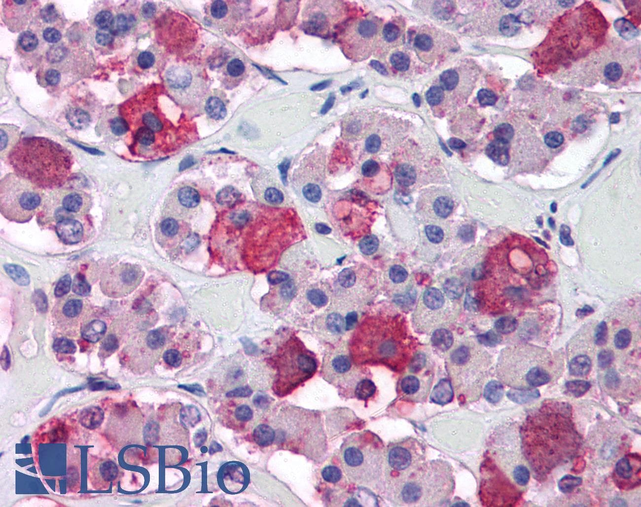 IHC-plus™ Monoclonal Mouse anti-Human ACTH Antibody (clone 57, N-Terminus, IHC)