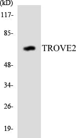 IHC-plus™ Polyclonal Rabbit anti-Human TROVE2 Antibody (aa302-351, IHC, WB)