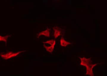 Polyclonal Rabbit anti-Human IF3mt / MTIF3 Antibody (IF, WB)