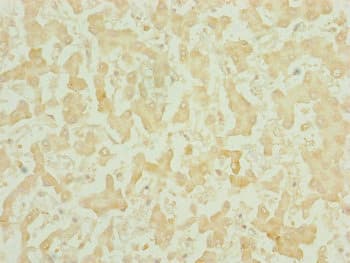 CHCHD3 Antibody