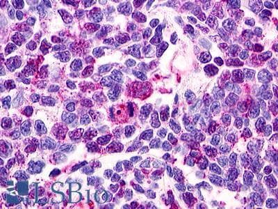 PathPlus™ RAIG2 / GPRC5B Antibody (C-Terminus)