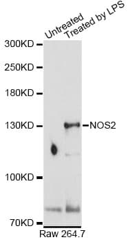 NOS2 / iNOS Antibody
