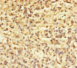 TMEFF2 Antibody
