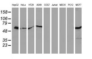 Monoclonal Mouse anti-Human SQSTM1 Antibody (clone OTI4E2, IHC, IF, WB)