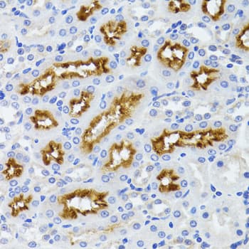 HFM1 Antibody