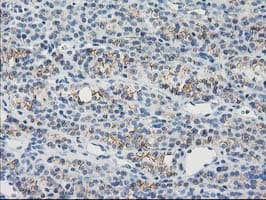 GUK1 / Guanylate Kinase 1 Antibody (clone OTI4A8)