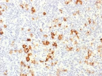 FUT4 / CD15 Antibody