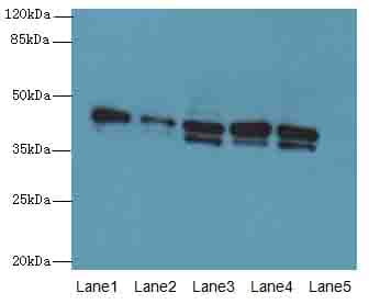 IHC-plus™ SGCA / DAG2 Antibody