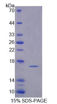 Mouse PFN4 Protein (Recombinant His, N-Terminal)