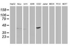 PON1 / ESA Antibody (clone OTI2A9)