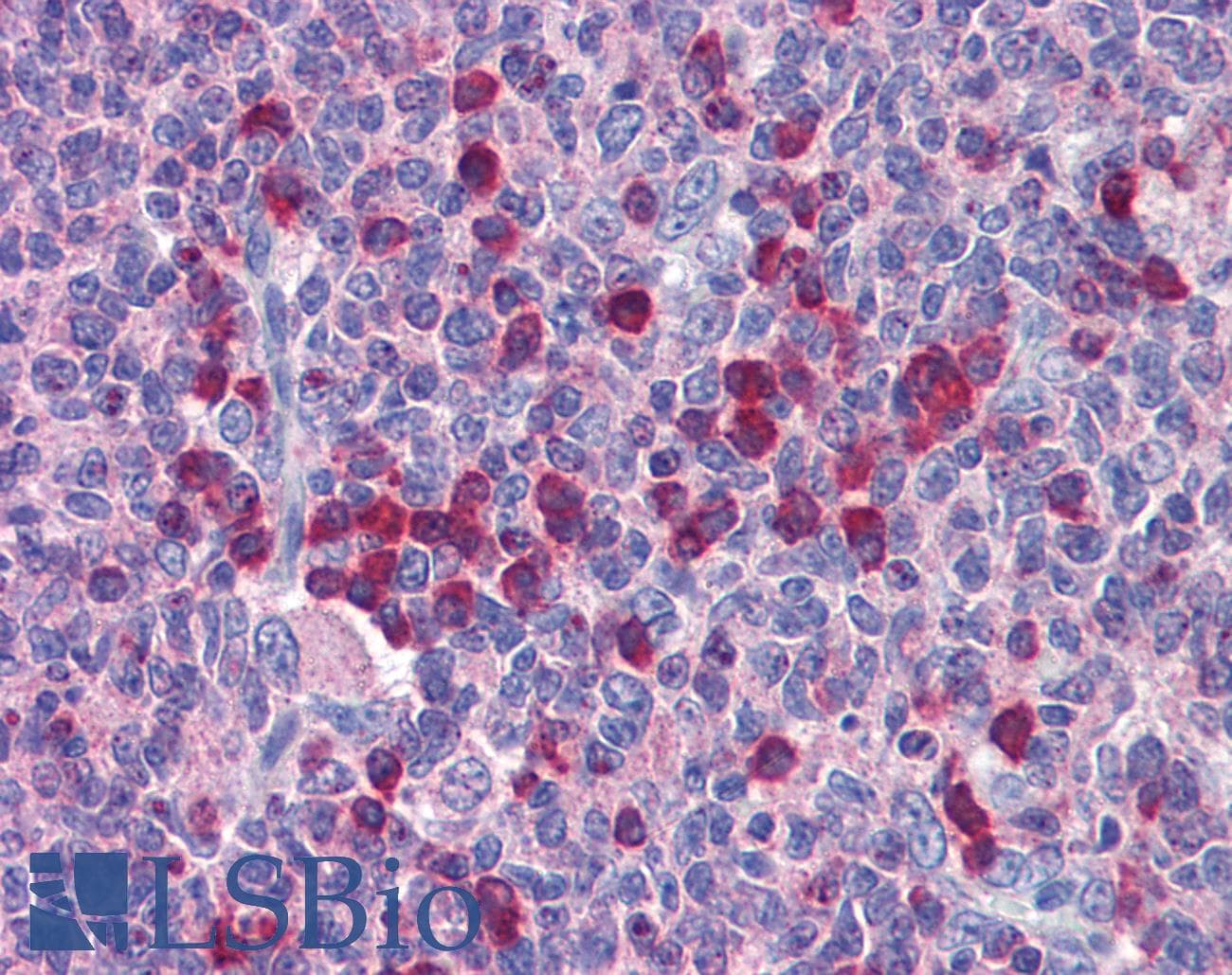 ROBO2 Antibody (aa252-301)