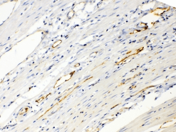 Polyclonal Rabbit anti-Human ANGPTL2 / ARP2 Antibody (IHC, WB)