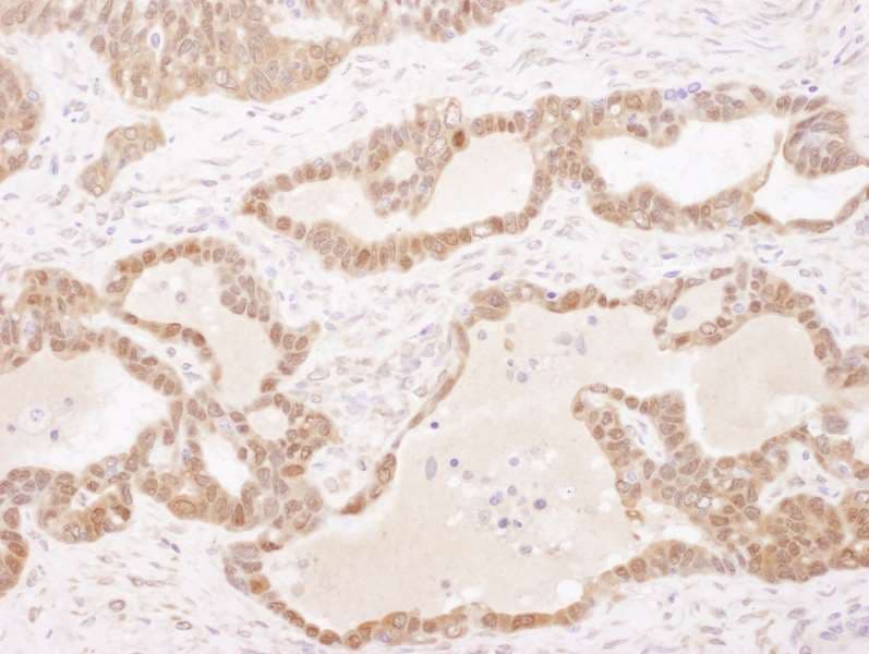 GSTP1 / GST Pi Antibody (aa160-210)