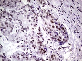 NBN / Nibrin Antibody (clone OTI6H7)