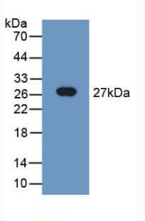 TUBD1 / Tubulin Delta Antibody (aa238-482)