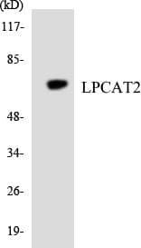 Polyclonal Rabbit anti-Human LPCAT2 Antibody (aa318-367, WB)