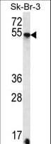 Polyclonal Rabbit anti-Human SDC3 / Syndecan 3 Antibody (aa413-442, WB)