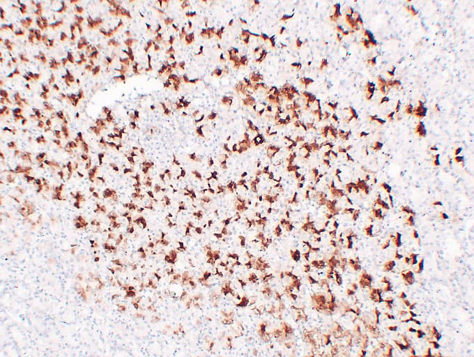 MUC6 / MUC-6 Antibody (clone ABT-MUC6)