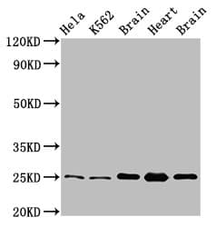 IHC-plus™ SOD2 / Mn SOD Antibody (aa64-175)