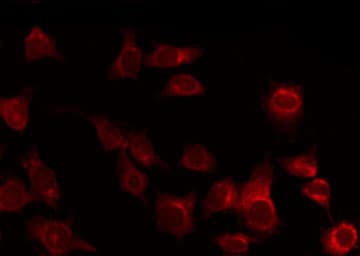 Tuberin / TSC2 Antibody