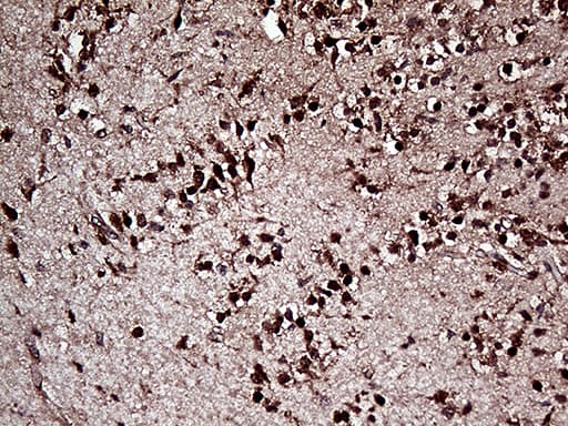 Monoclonal Mouse anti-Human OTX2 Antibody (clone OTI2B3, IHC, WB)