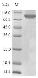 Mouse RAB10 Protein (Recombinant 6His-SUMO, N-terminus)