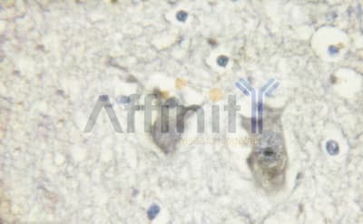 Polyclonal Rabbit anti-Human STX1A / Syntaxin 1A Antibody (IHC, IF, WB)