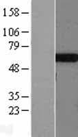 Human TS / Thromboxane Synthase Protein (Over-Expression Lysate Myc-DDK (Flag))