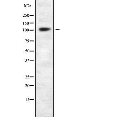 Polyclonal Rabbit anti-Human ACTN4 Antibody (IHC, WB)