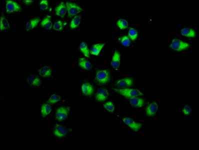 Polyclonal Rabbit anti-Human ITGA7 / Integrin Alpha 7 Antibody (IF)