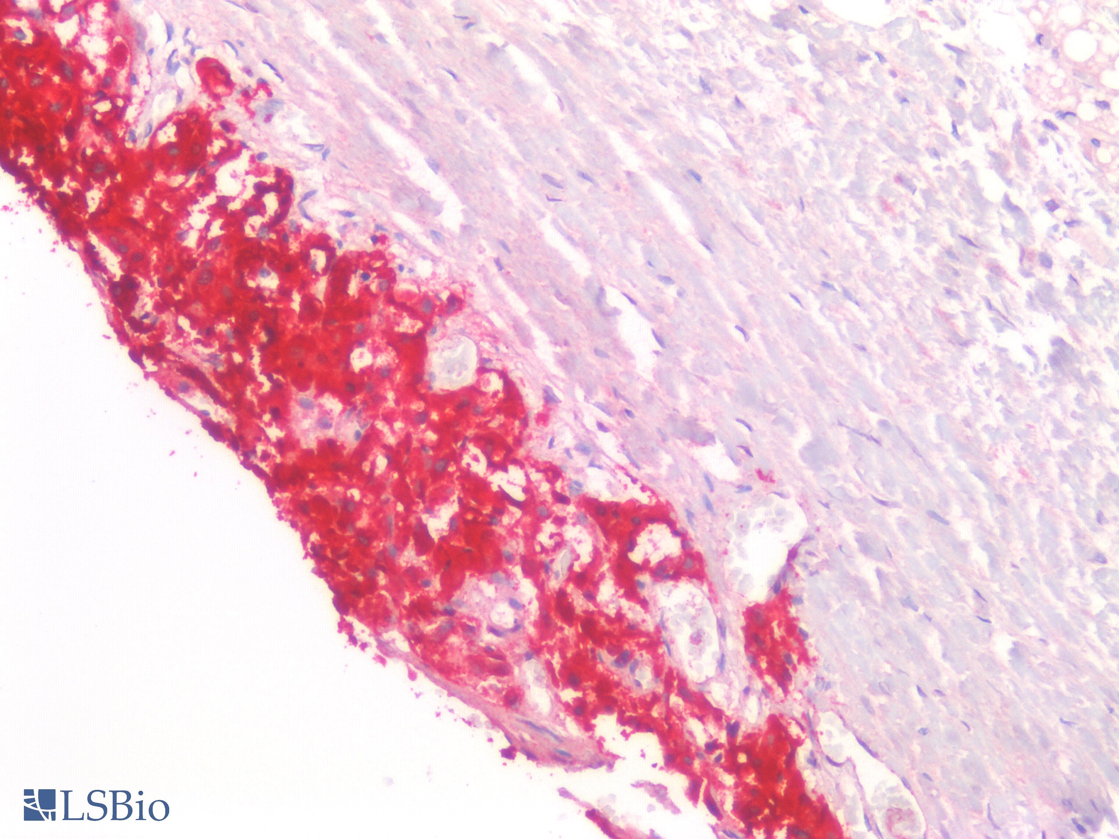 PathPlus™ CHGA / Chromogranin A Antibody