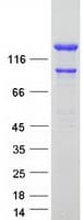 Human INF2 Protein (Recombinant Myc-DDK (Flag))