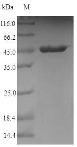 Campylobacter jejuni peb1A Protein (Recombinant 10His-SUMO, N-terminus + Myc, C-terminus)