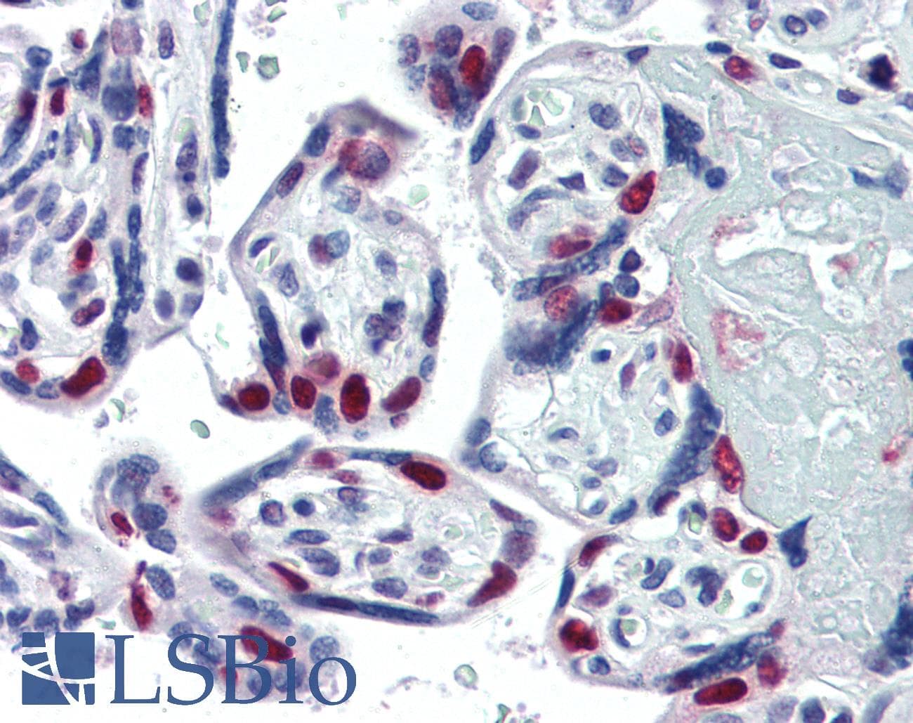 IHC-plus™ Monoclonal Mouse anti-Human PARP1 Antibody (clone A6.4.12, IHC, IF, WB)