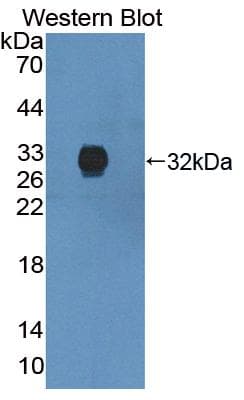 ANXA6/Annexin A6/Annexin VI Antibody (aa2-251, Biotin)