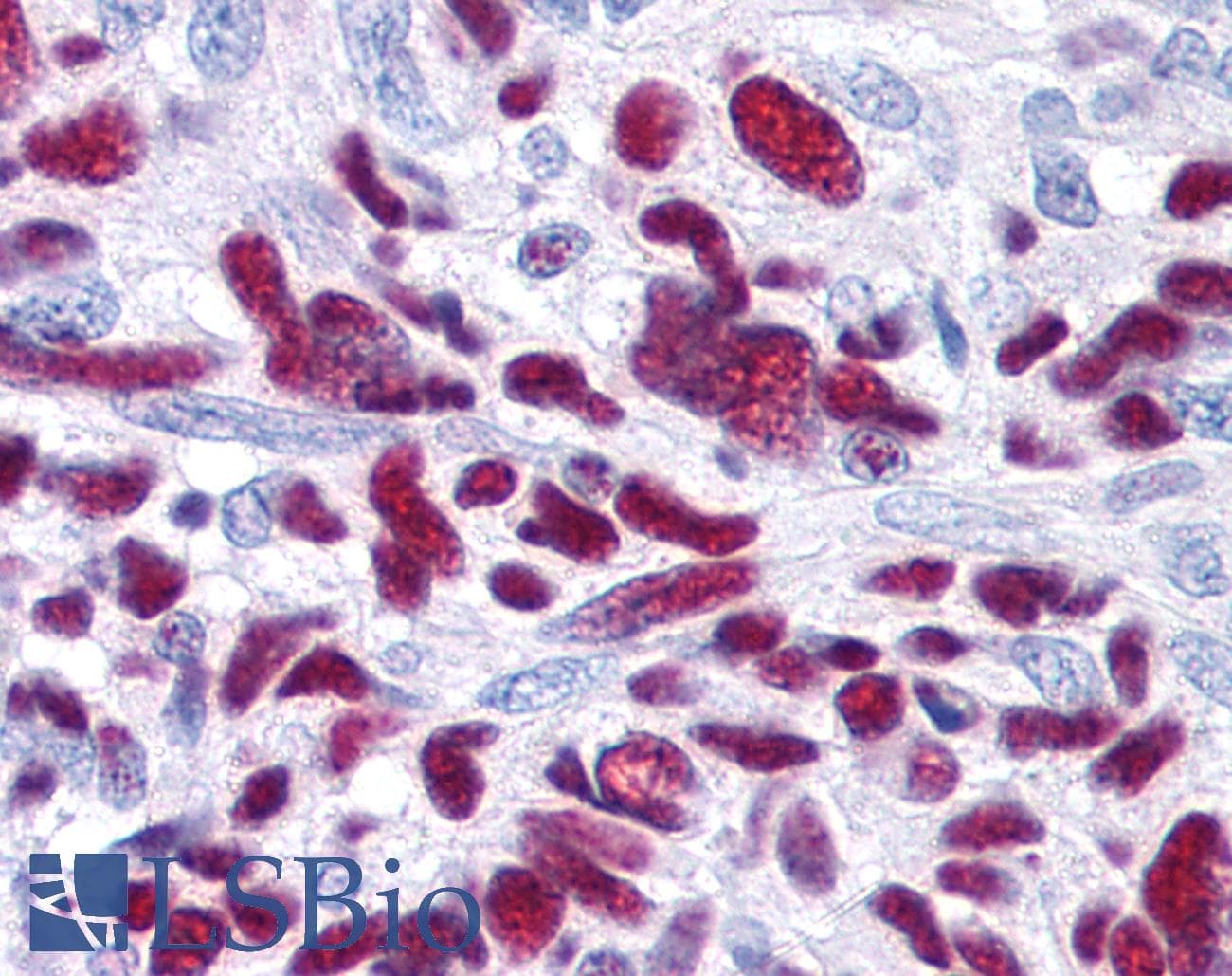 IHC-plus™ GLI3 Antibody